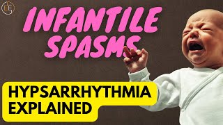 The Terrifying Truth About Infantile Spasms [upl. by Boony]