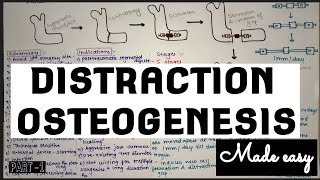 DISTRACTION OSTEOGENESIS  made easy [upl. by Ayr58]