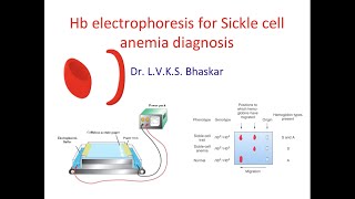 Hb electrophoresis for sickle cell anemia disease [upl. by Brewer]