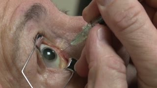 Eyeball injections equal eyepopping profits [upl. by Sylas]