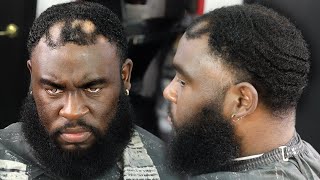 😳OMG😳 HE PAID 250 TO FIX HIS ALOPECIA WAVE LENGTH HIGH TAPER FADED BEARD HAIRCUT TUTORIAL [upl. by Carrelli]