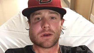 Diamondbacks Pitcher Takes 115 MPH Hit to His Face [upl. by Knowland]