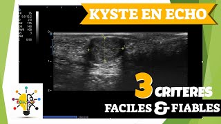 Diagnostiquer un kyste en échographie [upl. by Baxie275]