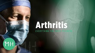 What is Arthritis  Everything You Need to Know About Arthritis [upl. by Elinad370]