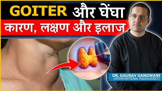 Important Things To Know About Thyroid Goiter  Dr Gaurav Gangwani Interventional Radiologist [upl. by Nerine]