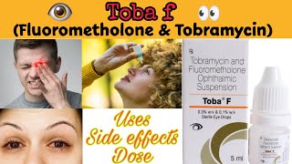 tobramycin and fluorometholone ophthalmic suspension  toba f eye drop  toba f [upl. by Elsa53]