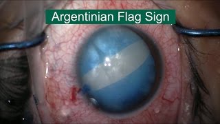 Argentinian Flag Sign [upl. by Daniella850]