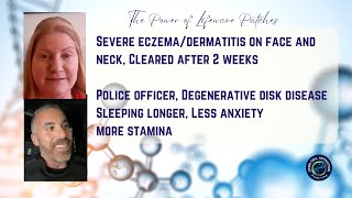 X39  Eczema cleared More Relief with Degenerative Disk Disease [upl. by Earas]