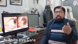 What Is Difference Between Pterygium and Pinguecula Causes and Treatment  Urdu Hindi [upl. by Milicent]