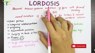 Lordosis  Medical Symptomatology [upl. by Cioban917]