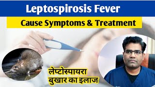 Leptospira Infection Cause Symptoms and Treatment in hindi  Leptospirosis  Fever [upl. by Ajnin]