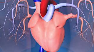 Catheter Ablation What is it and how does it help an irregular heart beat [upl. by Novel367]