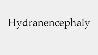 How to Pronounce Hydranencephaly [upl. by Port]