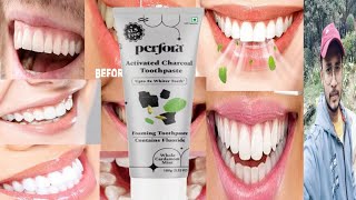 Perfora Activated Charcoal Toothpaste  Honest Review [upl. by Ardeha]