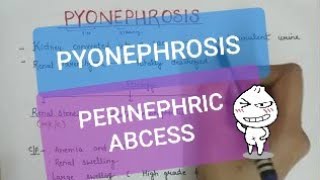 PYONEPHROSIS  PERINEPHRIC ABCESS [upl. by Buna]