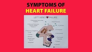 Symptoms of Heart Failure [upl. by Yornoc]