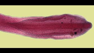 Diphyllobothrium  The Broad Fish Tapworm [upl. by Alyss]