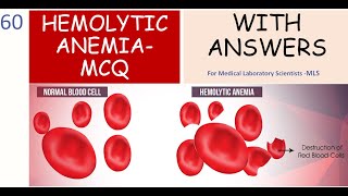 Hemolytic Anemia Review  MCQs With Answers [upl. by Ydnab]