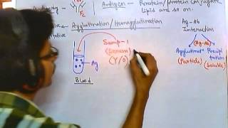 Antibody test qualitative [upl. by Maude]