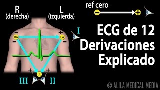 ECG de 12 Derivaciones Explicado Animación Alila Medical Media Español [upl. by Ednew]