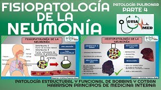 NEUMONÍA ADQUIRIDA EN LA COMUNIDAD FISIOPATOLOGÍA PARTE 1 GuiaMed [upl. by Enimisaj209]