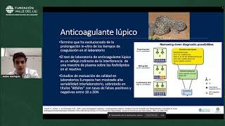 Monitoreo de anticoagulante lúpico en el paciente con anticoagulación oral  Dr Andrés Domínguez [upl. by Eiramanel]