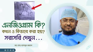 এনজিওগ্রাম কি কখন ও কিভাবে করা হয় সরাসরি দেখুন What is angiogram When and how is it done [upl. by Nikral]