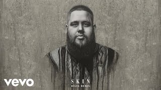 RagnBone Man  Skin Bilel Remix Audio [upl. by Ringo]