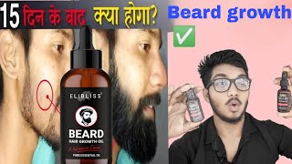 Ustraa beard growth oil use kaise karequotquot🔥ustraa beard growth oil use kaise karebeards oil [upl. by Astrahan406]