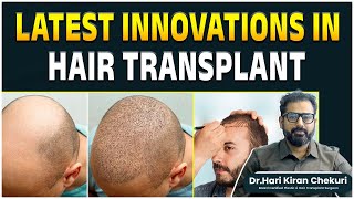 Latest Hair Transplant Technology  Best Hair Transplant Surgeon in Hyderabad  FUE Hair Transplant [upl. by Llyrpa344]