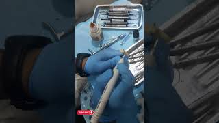 Avulsion Tooth Management  Splinting of Avulsed teeth  Dental Trauma [upl. by Raina]