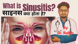 sinusitis treatment sinusitis kya haisinusitis ki symptoms sinusitis ki hoi sinusitis ki ilaj [upl. by Ettenyl]