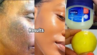 How to apply vaseline and lemon on face apply vaseline on your skin and see the magic [upl. by Lumpkin238]