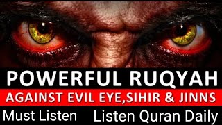 RUQYAH SHARIAH  POWERFULL DUA  AGAINST BAD EVIL EYE BLACKMAGIC SAHAR JINN [upl. by Carolynn]