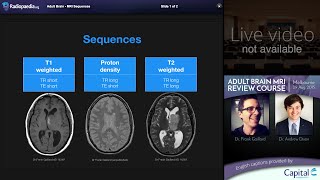 MRI Brain Sequences  radiology video tutorial [upl. by Eugene941]