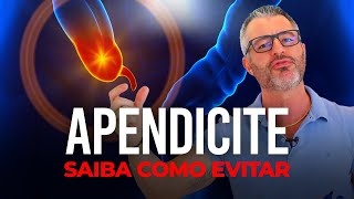 APENDICITE sintomas tratamento e prevenção [upl. by Otreblada105]