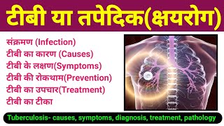 टीबी रोग  tb or tapedik  Tuberculosis causes symptoms diagnosis treatment pathology  biology [upl. by Emmalynne]