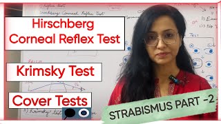 Strabismus Part 2  Hirschberg Corneal Reflex Test  Krimsky Test  Cover Tests [upl. by Ede]