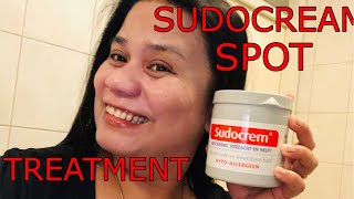 Get rid of spots acne and blemishes FAST Sudocream Face Mask [upl. by Inez]