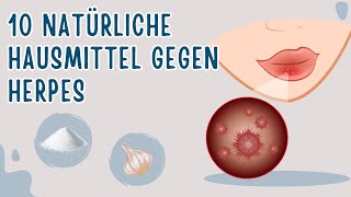 10 Natürliche Hausmittel gegen Herpes [upl. by Esinehs]