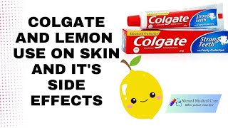 Colgate toothpaste for face whitening Lemon and Colgate their side effects ahmedmedicalcare [upl. by Alilad]