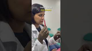 Skin Biopsy 💉🧏‍♀️ Procedure By Dermatologist  Dr Priyanka Reddy  DNA Skin Clinic  shorts [upl. by Bjorn575]