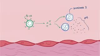 Vasculitis  Osmosis [upl. by Artsa]