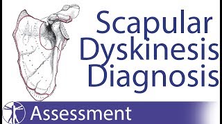 Diagnosing Scapula Dyskinesia [upl. by Dimo]