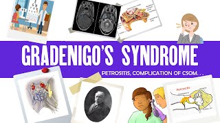 Gradenigo syndrome  Petrositis  Complications of CSOM  Ear disease  ENT [upl. by Lyda]