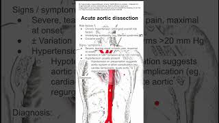 Acute aortic dissection [upl. by Yadsendew803]