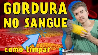 Gordura no Sangue Como prevenir a formação de placa nas artérias [upl. by Akinek3]