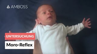 MoroReflex  Frühkindliche Reflexe  AMBOSS Video [upl. by Buttaro297]