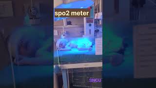 SNCU  neonatal care articles 🥰 short video 😍 trending reel [upl. by Chaiken]