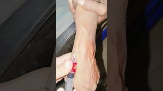 How intravenous injection given to pt viralyoutubeshorts ivinjection viralvideo trending [upl. by Ramma]